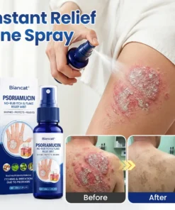 Biancat® PsoriaMucin No-Rub Itch & Flake Relief Mist