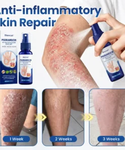 Biancat® PsoriaMucin No-Rub Itch & Flake Relief Mist
