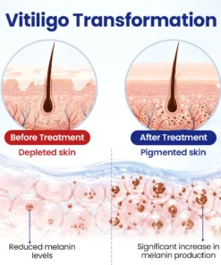 Biancat® VitiRepair Advanced Spray