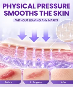 Biancat® ScarMatrix Hyaluronic Acid Nano Microneedle Repair Tape